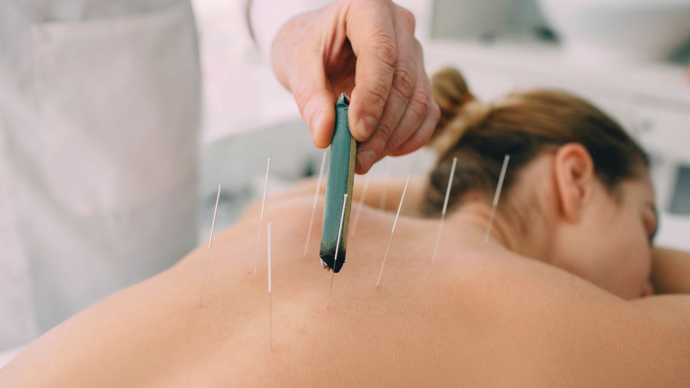 Equilibrar os meridianos com acupuntura