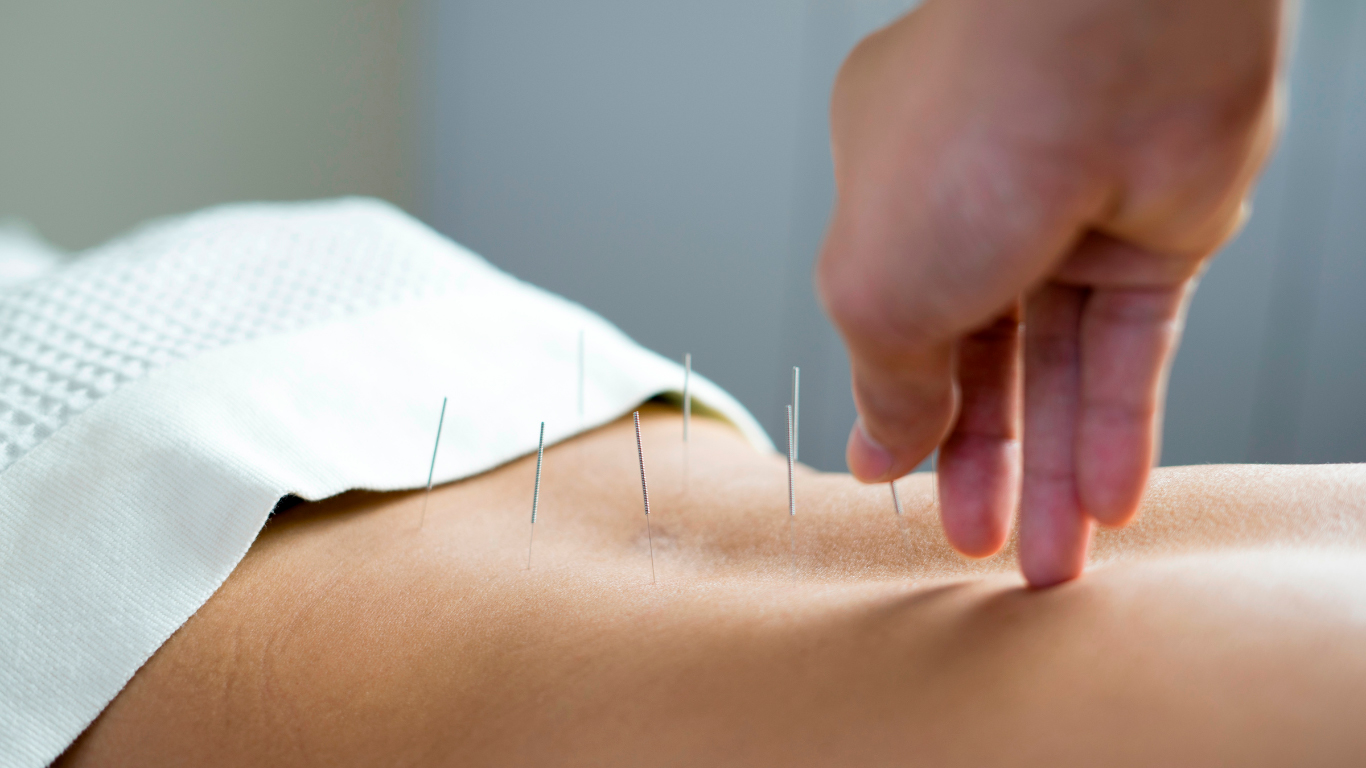 Atendimento Profissional Yasmin Araujo Acupuntura