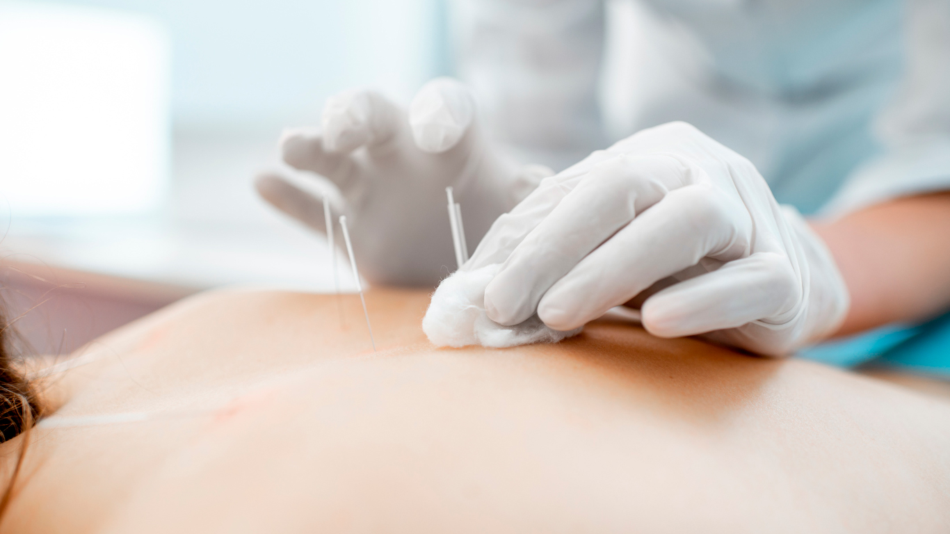 Tratamento de Acupuntura Clínica Flora